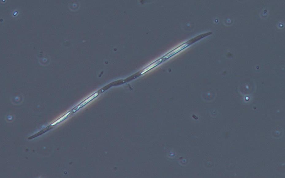 Photographie d'une cellule de phytoplancton